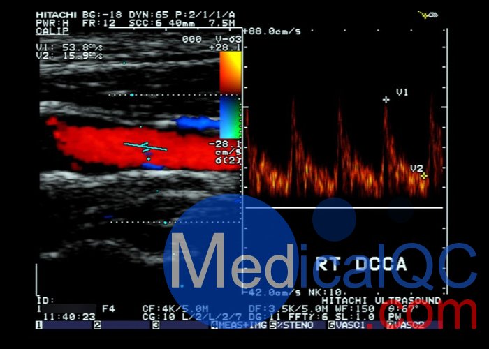 CIRS 043多普勒模體，CIRS 043 Mark 4多普勒超聲模體