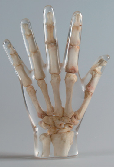 Erler Zimmer天然骨骼模體，Erler Zimmer手掌模體