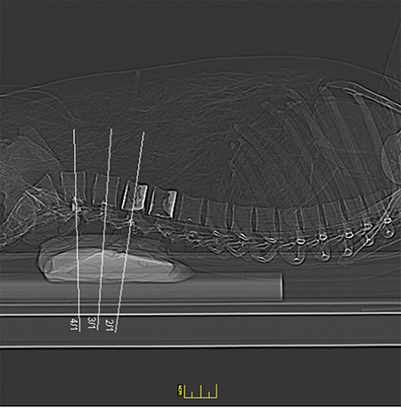 德國(guó)Erler Zimmer 7200天然骨骼全身模體，EZ 7200全身模體