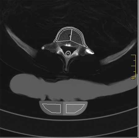 德國(guó)Erler Zimmer 7200天然骨骼全身模體，EZ 7200全身模體