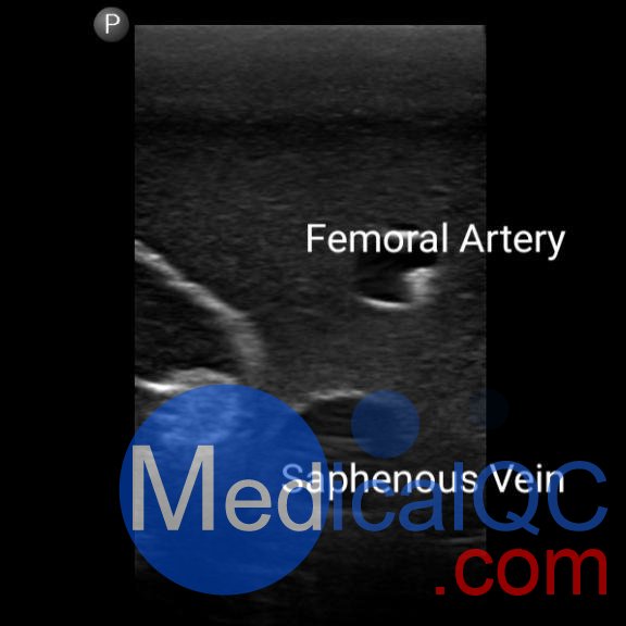 BPF1500-HP血管通路和區(qū)域麻醉超聲訓(xùn)練模體，BPF1500-HP區(qū)域麻醉超聲模體