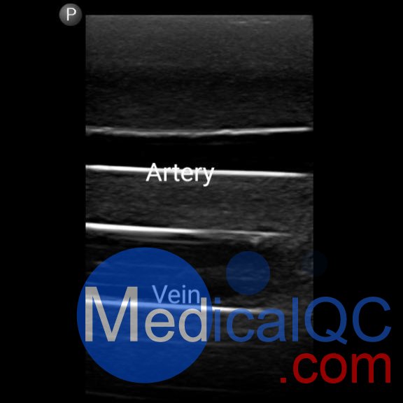 BPF1500-HP血管通路和區(qū)域麻醉超聲訓(xùn)練模體，BPF1500-HP區(qū)域麻醉超聲模體