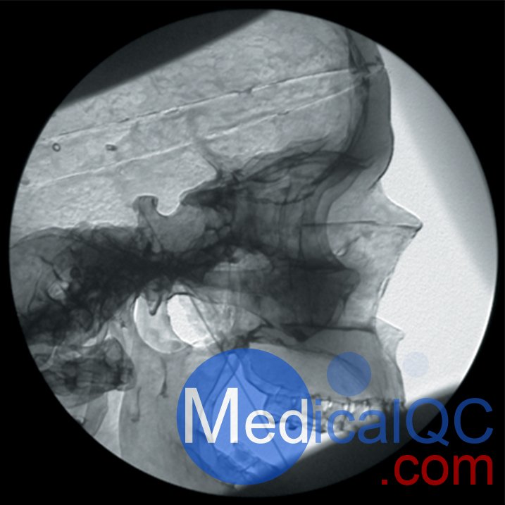 AR351脊椎穿刺模體，Adam，Rouilly脊椎穿刺模體