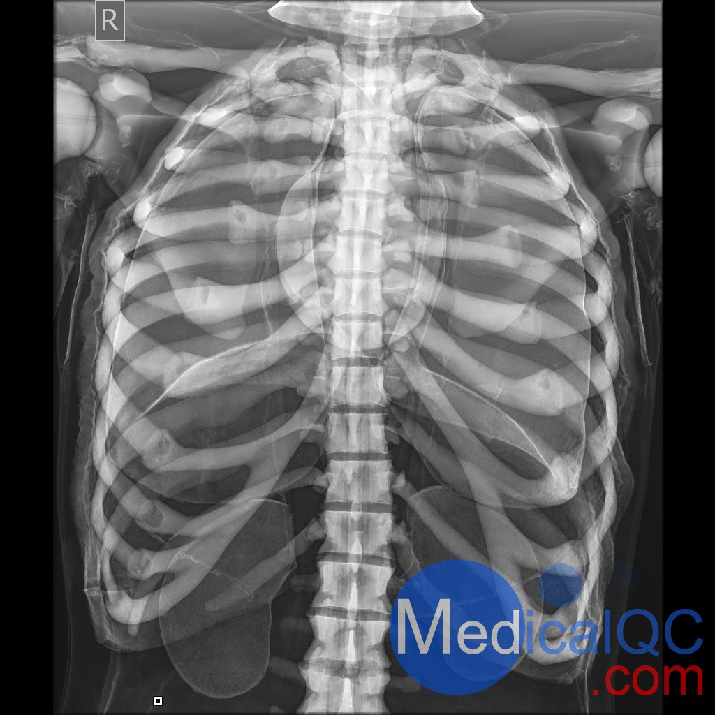 AR10A全身X射線照相定位模體，AR10A全身模體，AR10A X射線成像模體