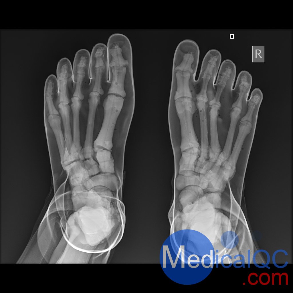 AR10A全身X射線照相定位模體，AR10A全身模體，AR10A X射線成像模體