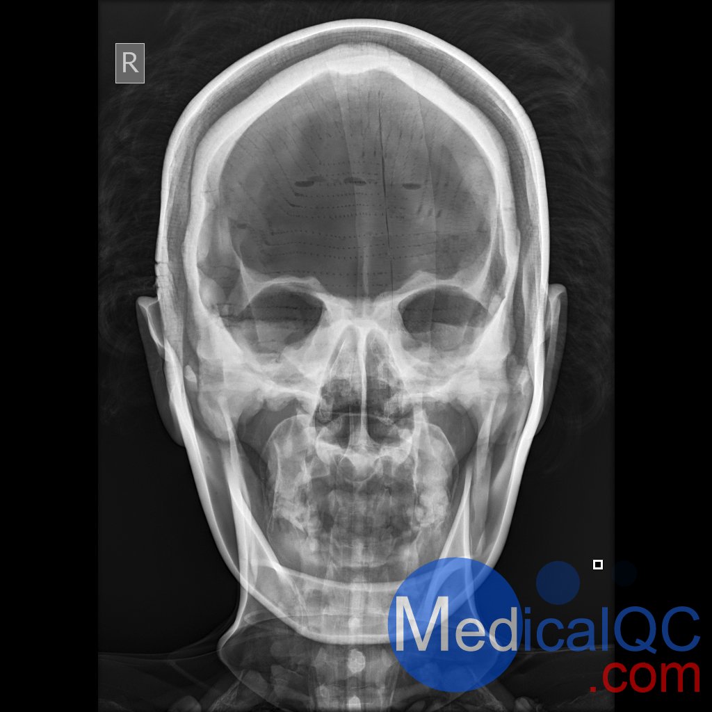 AR10A全身X射線照相定位模體，AR10A全身模體，AR10A X射線成像模體