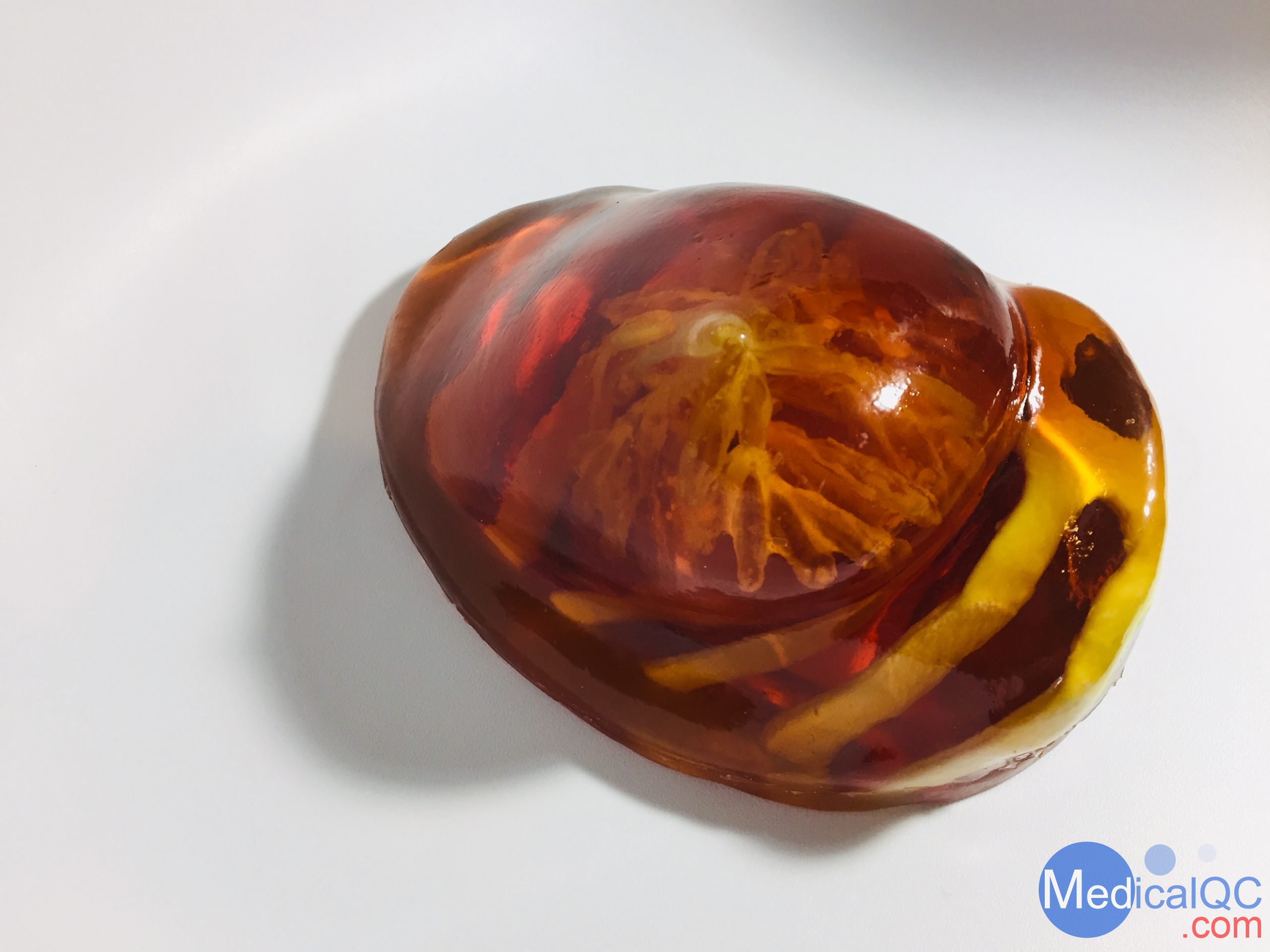 BT-A01乳房模體，BT-A01解剖乳房模體，Breast Phantom