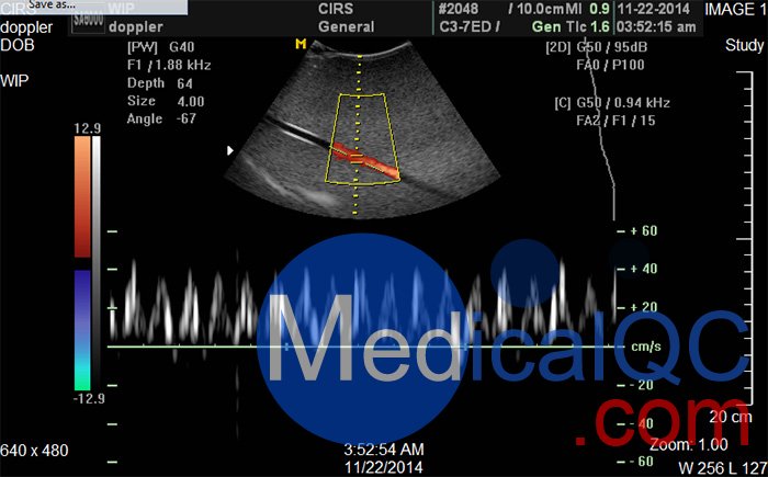 CIRS 769多普勒流量泵，CIRS 769血流測試系統(tǒng)