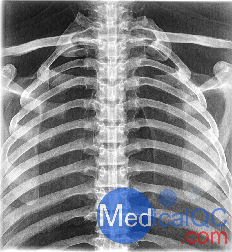 EZ7400真人骨胸部模體，EZ7400 X射線胸部模體