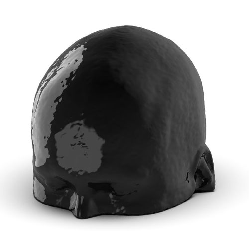 WEK50-04 CTA頭模，帶AVM CTA頭模，WEK50-04 CT血管造影頭模