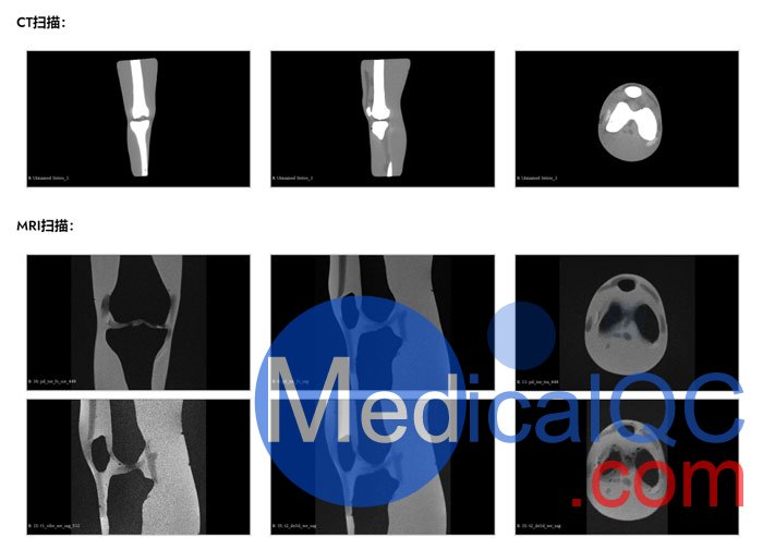KE-A03成人膝關(guān)節(jié)，KE-A03膝關(guān)節(jié)模體,KE-A03膝關(guān)節(jié)模型成像效果圖