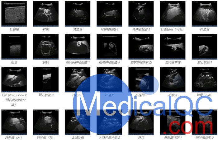 US-A04 FAST訓(xùn)練軀干模體，US-A04超聲軀干模體