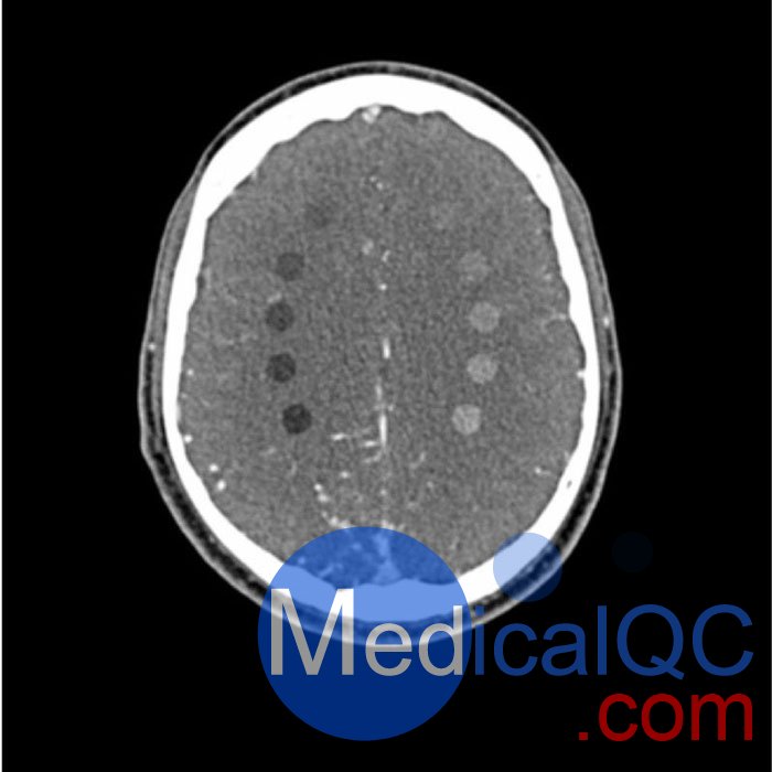 WEK-5005腦血管造影頭模，WEK-5005頭模， CTA AVM頭模成像效果圖