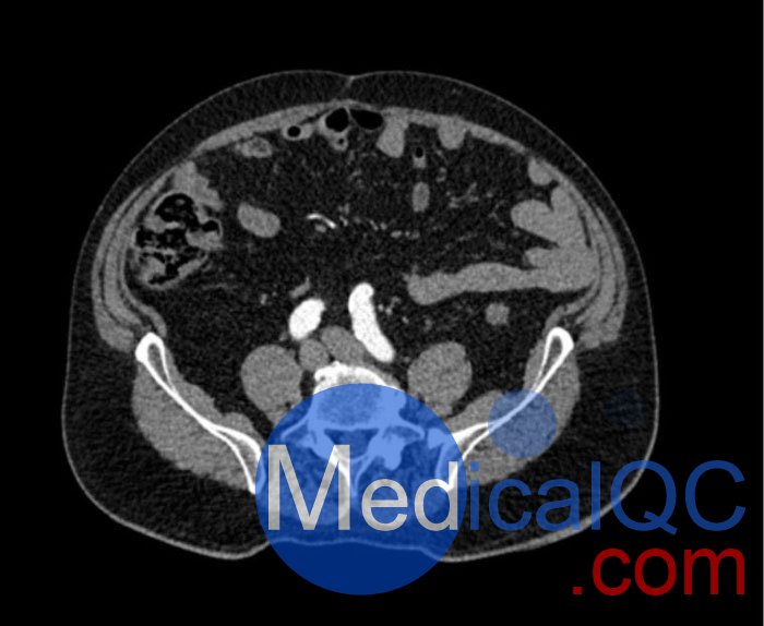 WEK53-05腹部模體，WEK53-05動脈瘤腹部模體