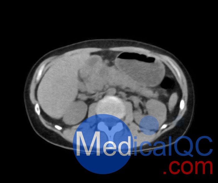WEK55-02腹部骨盆模體，WEK55-02腹部骨盆模型成像效果圖