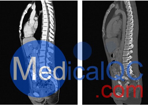 WEK57-01門(mén)靜脈期軀干模體,WEK57-01軀干模型