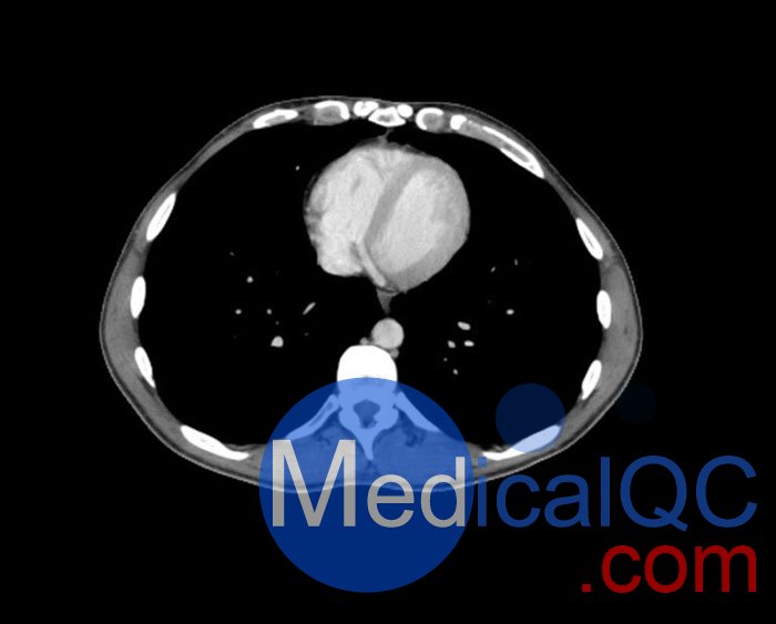 WEK57-01門(mén)靜脈期軀干模體,WEK57-01軀干模型成像效果圖