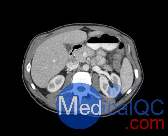 WEK57-01門(mén)靜脈期軀干模體,WEK57-01軀干模型成像效果圖