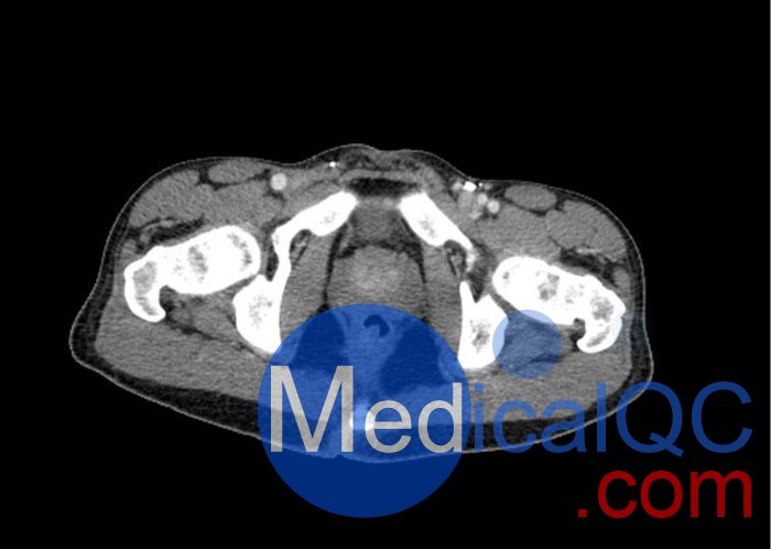 WEK57-01門(mén)靜脈期軀干模體,WEK57-01軀干模型成像效果圖