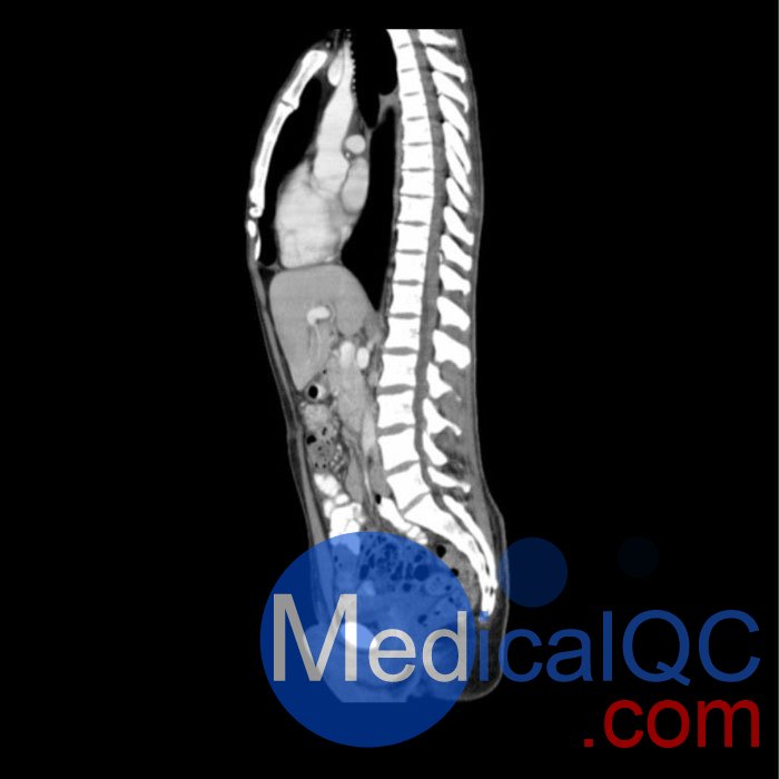 WEK57-01門(mén)靜脈期軀干模體,WEK57-01軀干模型成像效果圖