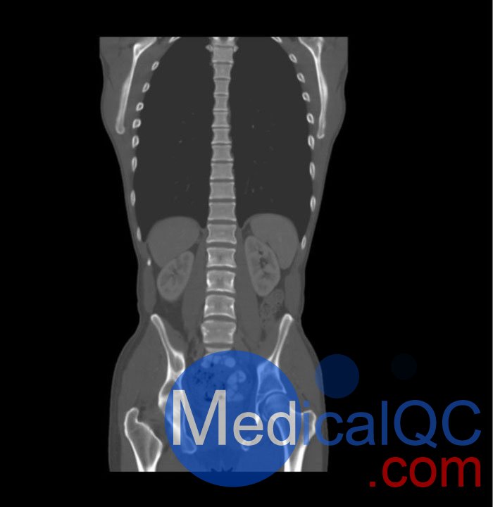 WEK57-01門(mén)靜脈期軀干模體,WEK57-01軀干模型成像效果圖